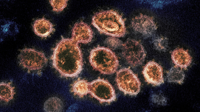 A close-up of the virus that causes COVID-19
